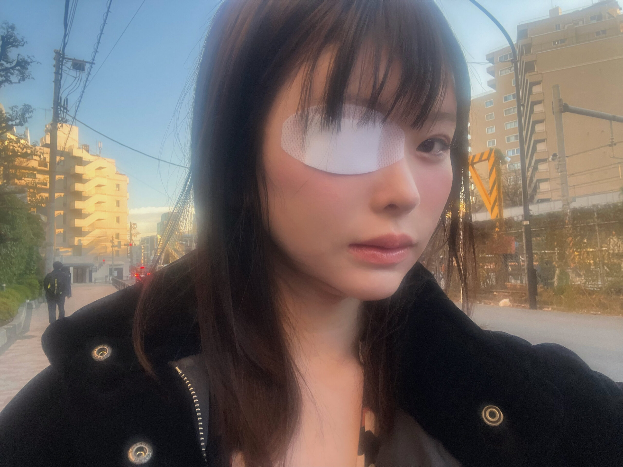 松本丽铃(原明日见未来)被前男友打到受伤。